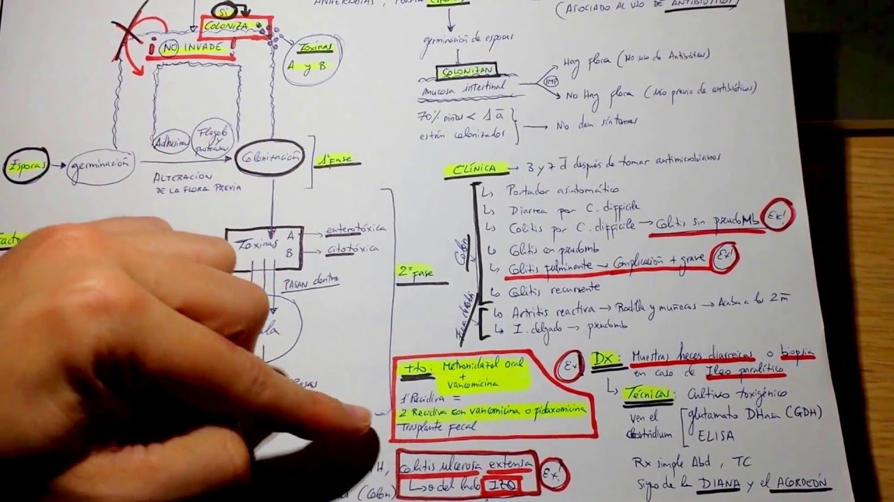 Clostridium Difficile MUY FACIL ESQUEMA