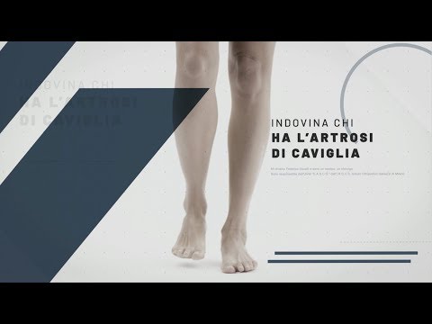 Quando il ponte tratta articolazioni Carica video di osteocondrosi collo