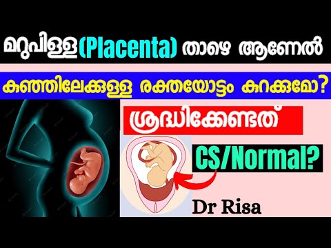 Pregnancy Complication Malayalam|Low Lying Placenta|Placenta previa Malayalam