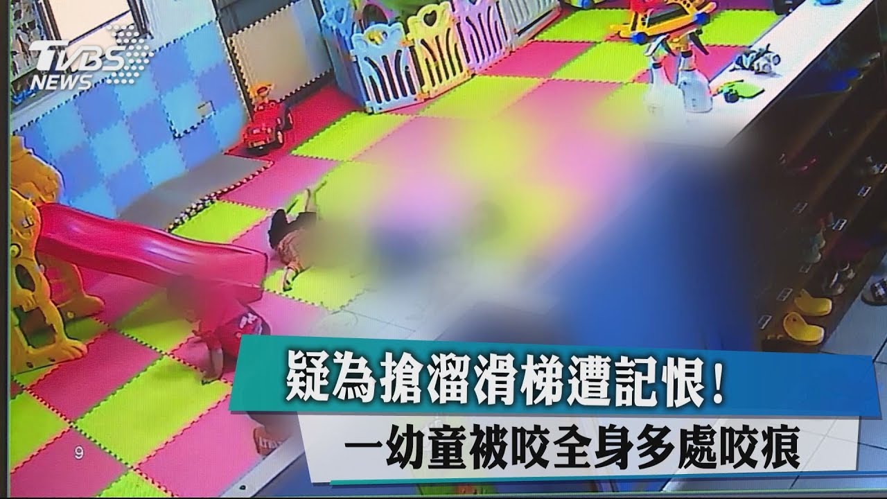疑為搶溜滑梯遭記恨! 一幼童被咬全身多處咬痕