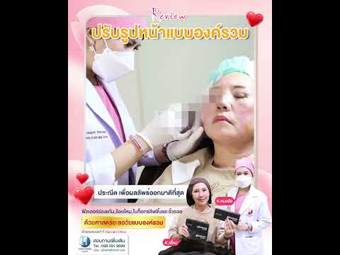 รีวิวหัตถการโปรแกรมปรับรูปหน้าแบบองค์รวม