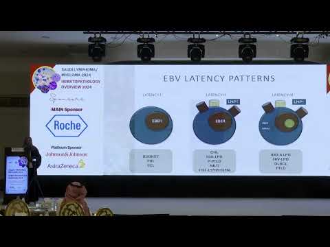 08 EBV associated lymphoproliferative disorders | Dr. Shamayel Mohammed | 26 Oct 2024