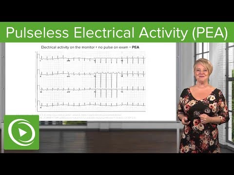 image-What is pulseless electrical activity (PEA)?
