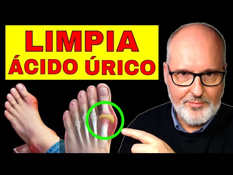 How to Reduce Uric Acid and Effectively Control Gout