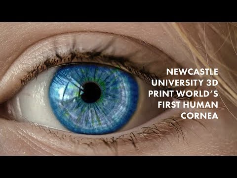 Đại học Newcastle in 3D giác mạc người đầu tiên trên thế giới (trailer)