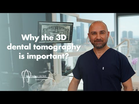 Üç boyutlu diş tomografisi neden önemlidir?