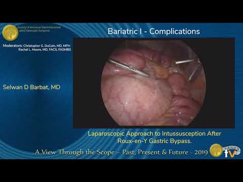 Laparoscopic Approach to Intussusception After Roux-en-Y Gastric Bypass