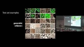 Cellpose: a generalist algorithm for cellular segmentation