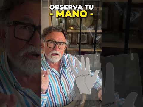 🔮 Are any of the lines on your hand broken? 🔮