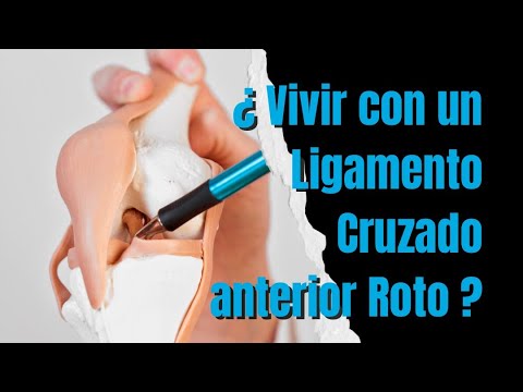 Vivir con un ligamento cruzado anterior roto , ¿ es posible ? ¿ Qué consecuencias tiene ?