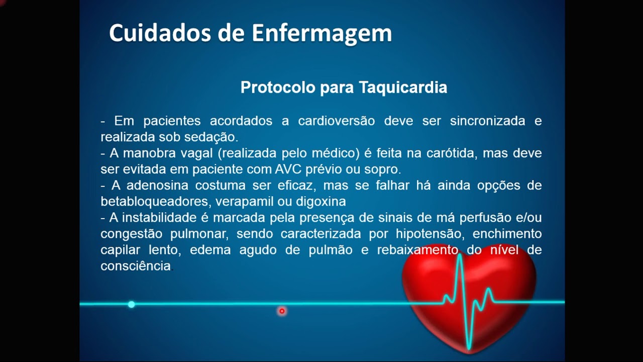 Cuidados de Enfermagem nas Arritmias Cardíacas