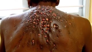 When Botflies Attack