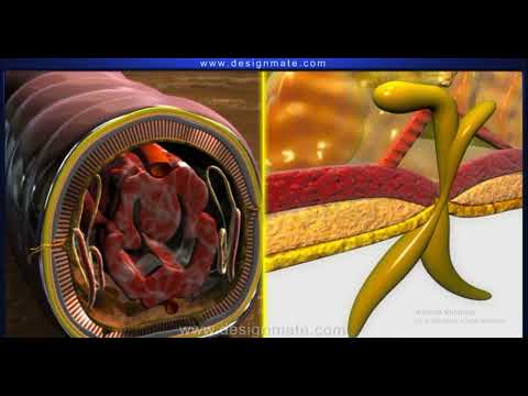 Locomotion in an earthworm