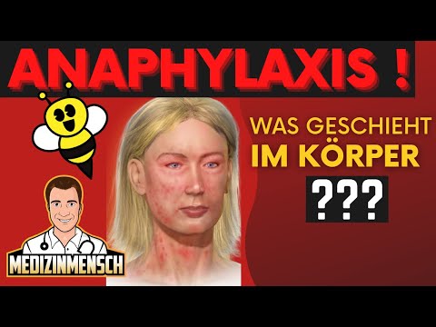 Anaphylactic shock: What happens in the body? (Doctor explains)