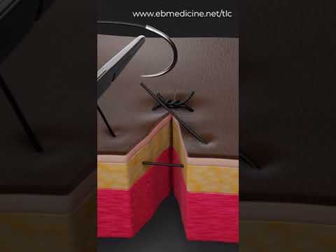 Simple interrupted suture animation with commentary