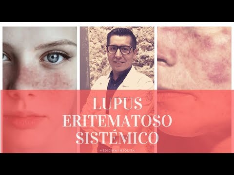 ¡LUPUS ERITEMATOSO SISTÉMICO! || Medicina Insólita || StoryTime || Capitulo 3