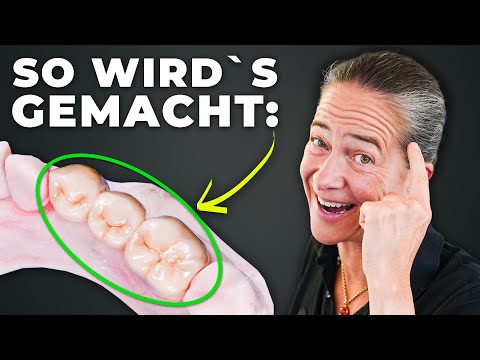 Zahnärztin klärt auf: Zahnkronen: DAS wissen viele nicht...!