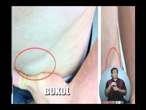 Mga larawan ang maaari kong magbawas ng timbang Kalkulahin ang calories sa mawala timbang
