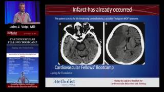 Download Lagu Diagnosis and Medical Management of Stroke (John J. Volpi, MD) Thumbnail