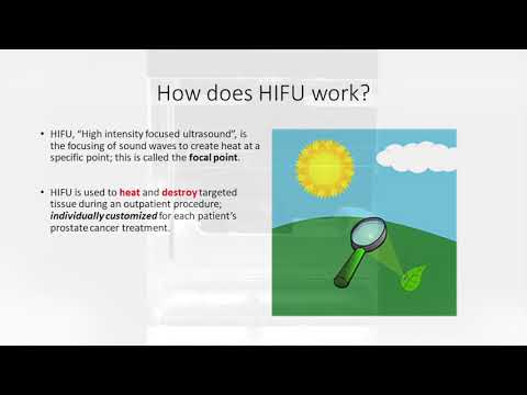 How High Intensity Focused Ultrasound Treatment Works for Prostate Cancer Works