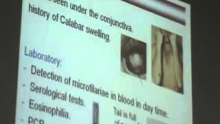 Dr Azza 16 18 12 2014   YouTube