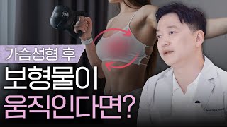 애니메이션 현상에 대하여