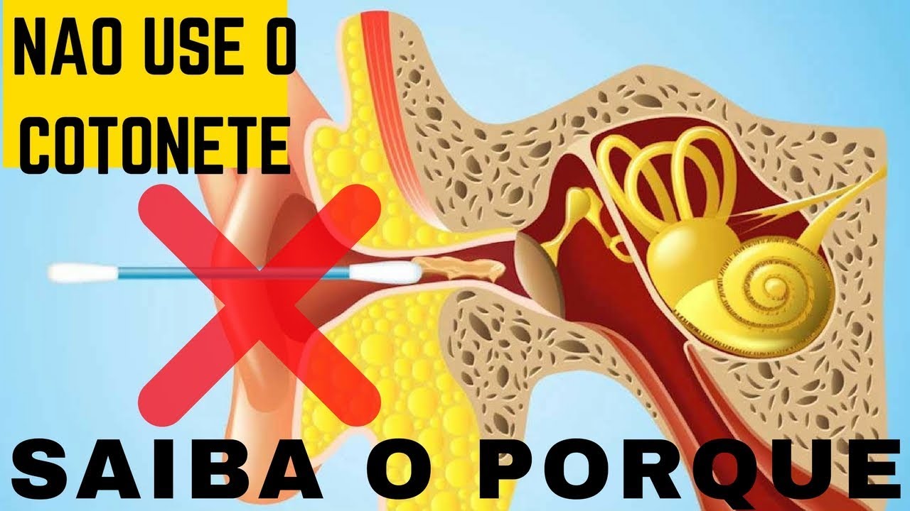 Watch Now COMO DEVO FAZER A LIMPEZA DOS OUVIDOS ou LAVAGEM DOS OUVIDOS/ Dr. Paulo Mendes Jr - COMO DEVO FAZER A LIMPEZA DOS OUVIDOS ou LAVAGEM DOS OUVIDOS/ Dr. Paulo Mendes Jr -