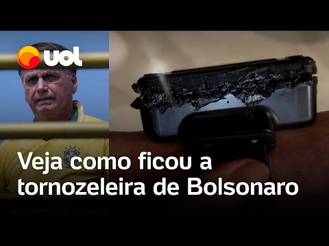 Bolsonaro preso: veja como ficou a tornozeleira eletrônica após o ex-presidente tentar rompê-la