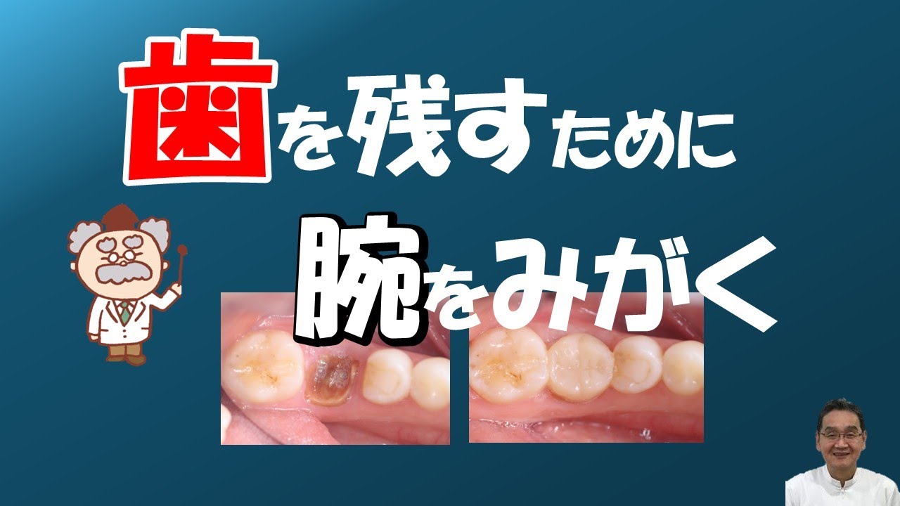 歯を残すために腕をみがく