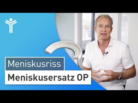 Meniscus replacement surgery: Replacement of the meniscus with an implant or transplantation