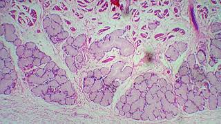 Histologia esôfago