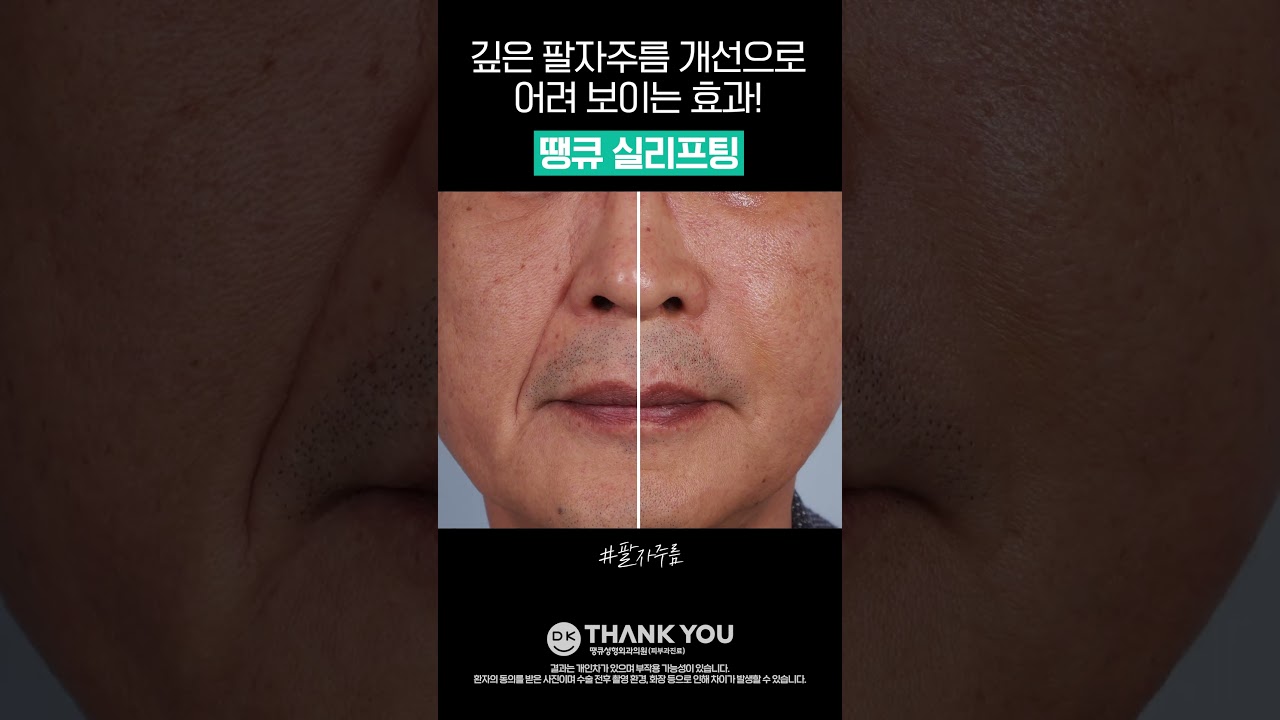 땡큐성형외과 Clips