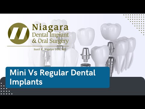 Mini Vs Regular Dental Implants