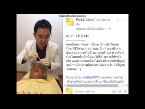 ร้อยไหม หน้าเรียว