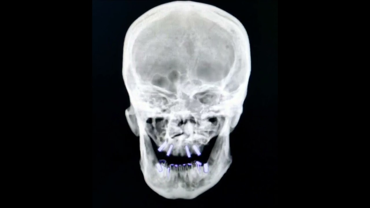 Juan Alberto Vidales Santiago-9