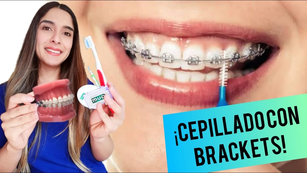 COMO CEPILLAR TUS DIENTES CON BRACKETS ✅ | LA MEJOR TÉCNICA Y TODO LO QUE NECESITAS❗❗