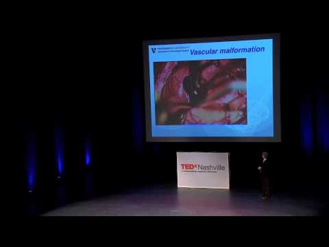TedxNashville - Reid Thompson - Neurosurgery: Open the Windows of the Mind