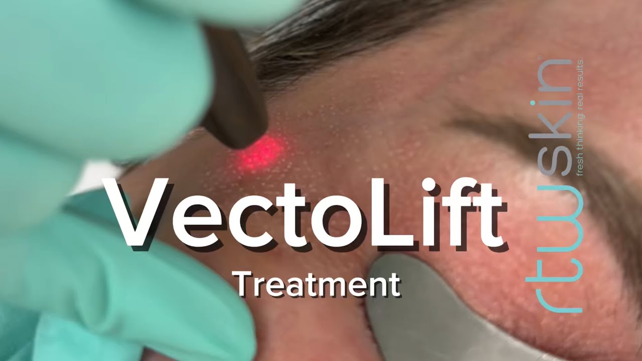 YouTube Video Preview