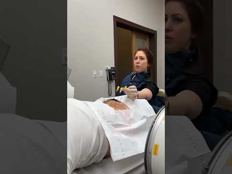 What is lumbar radiofrequency nerve ablation (RFA) - facet joint arthritis