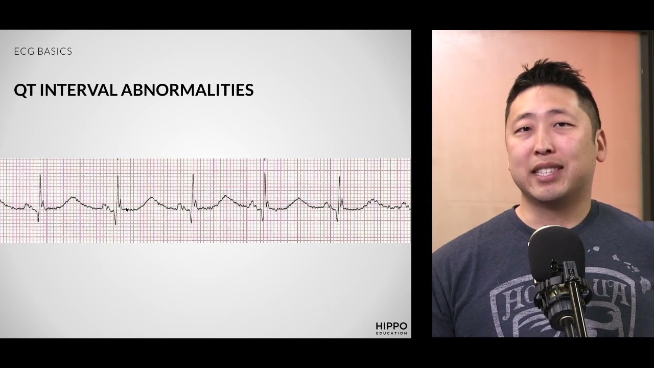 Basic ECG Interpretation