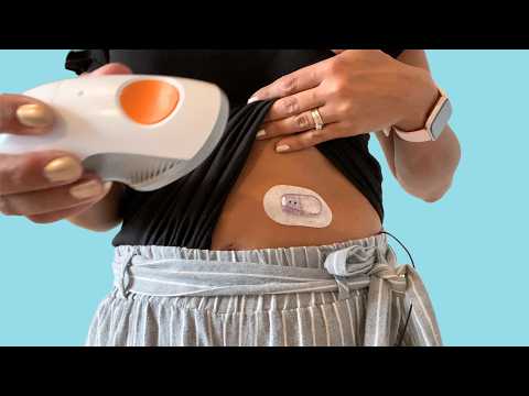 How to Change Your Dexcom G6 CGM - Easy to follow guide