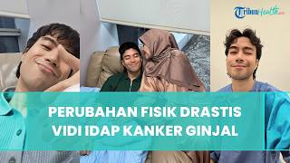 Sempat Terlihat Kurus dan Pucat, Perubahan Fisik Vidi Aldiano seusai Idap Kanker Ginjal Disorot