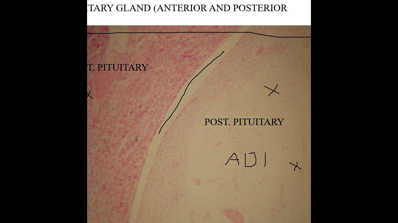 endocrine lab slide w audio