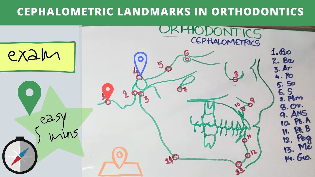 cephalometric landmarks in orthodontics