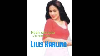 Download lagu LILIS KARLINA - MASIH ADA LUKA mp3