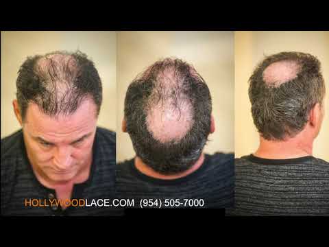 Hair System, Toupee, Hairpiece For Men Hollywood Lace