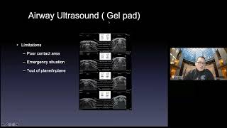 Point of Care Airway Ultrasound.