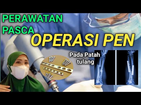 PERAWATAN PASCA PEMASANGAN PEN PADA PATAH TULANG
