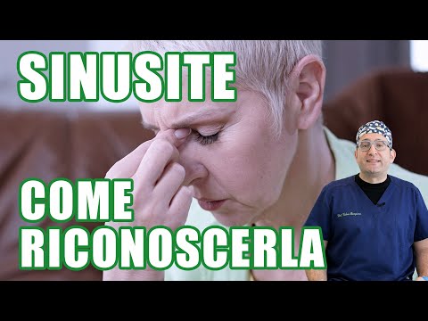 Sinusite cronica scopri subito se ne soffri