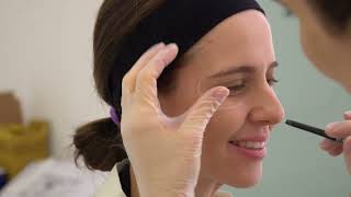 Bioestimulador de Colágeno Radiesse - Passo a Passo de Aplicação na Face - Dra Giselle Barban